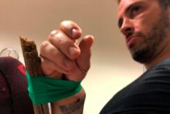 Andrea Dovizioso leison muneca