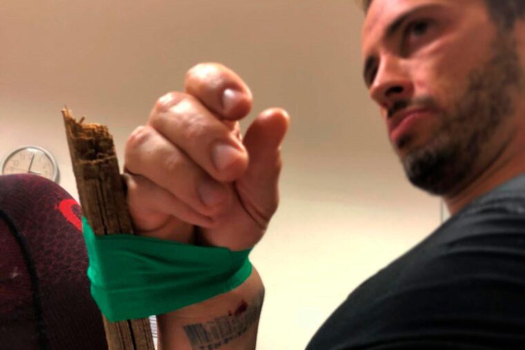 Andrea-Dovizioso-leison-muneca