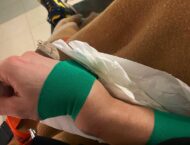 Andrea Dovizioso se destroza la muñeca practicando motocross 5 Andrea Dovizioso lesion mano (1)