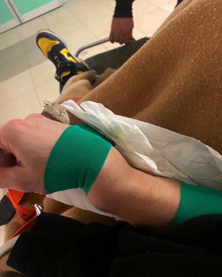 Andrea-Dovizioso-lesion-mano (1)