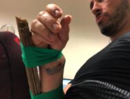 Andrea Dovizioso se destroza la muñeca practicando motocross 6 Andrea Dovizioso lesion mano (7)