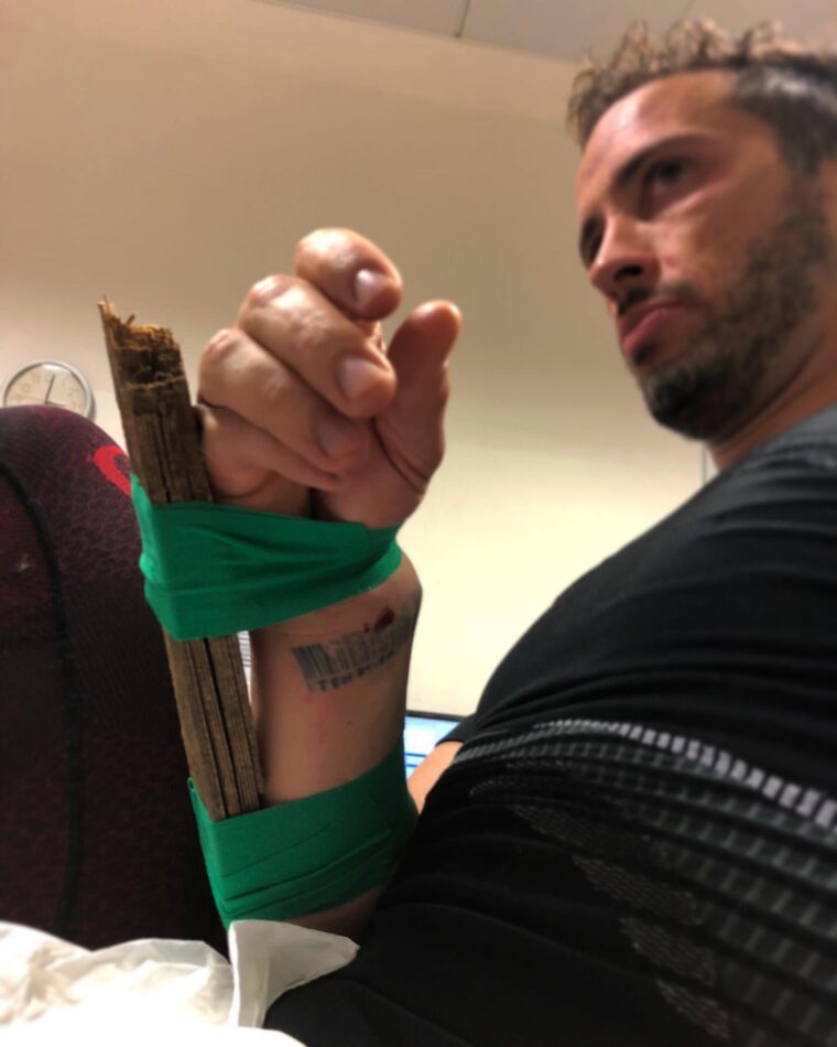 Andrea-Dovizioso-lesion-mano (7)