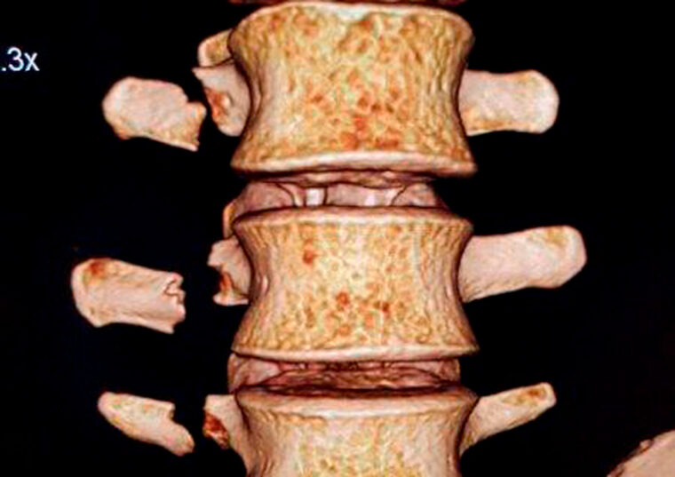 entrevista toni bou 8